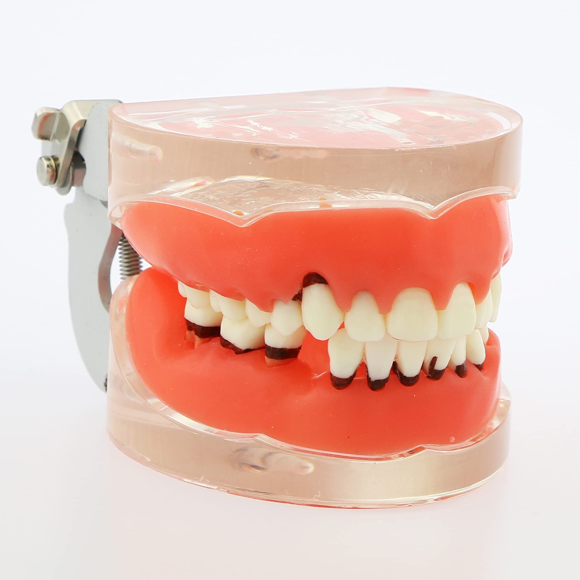 Adult Transparent Dental Teeth Model - Removable Gingivae for Pathology Study & Teaching - Perfect for Dental Students, Dentists & Medical Professionals