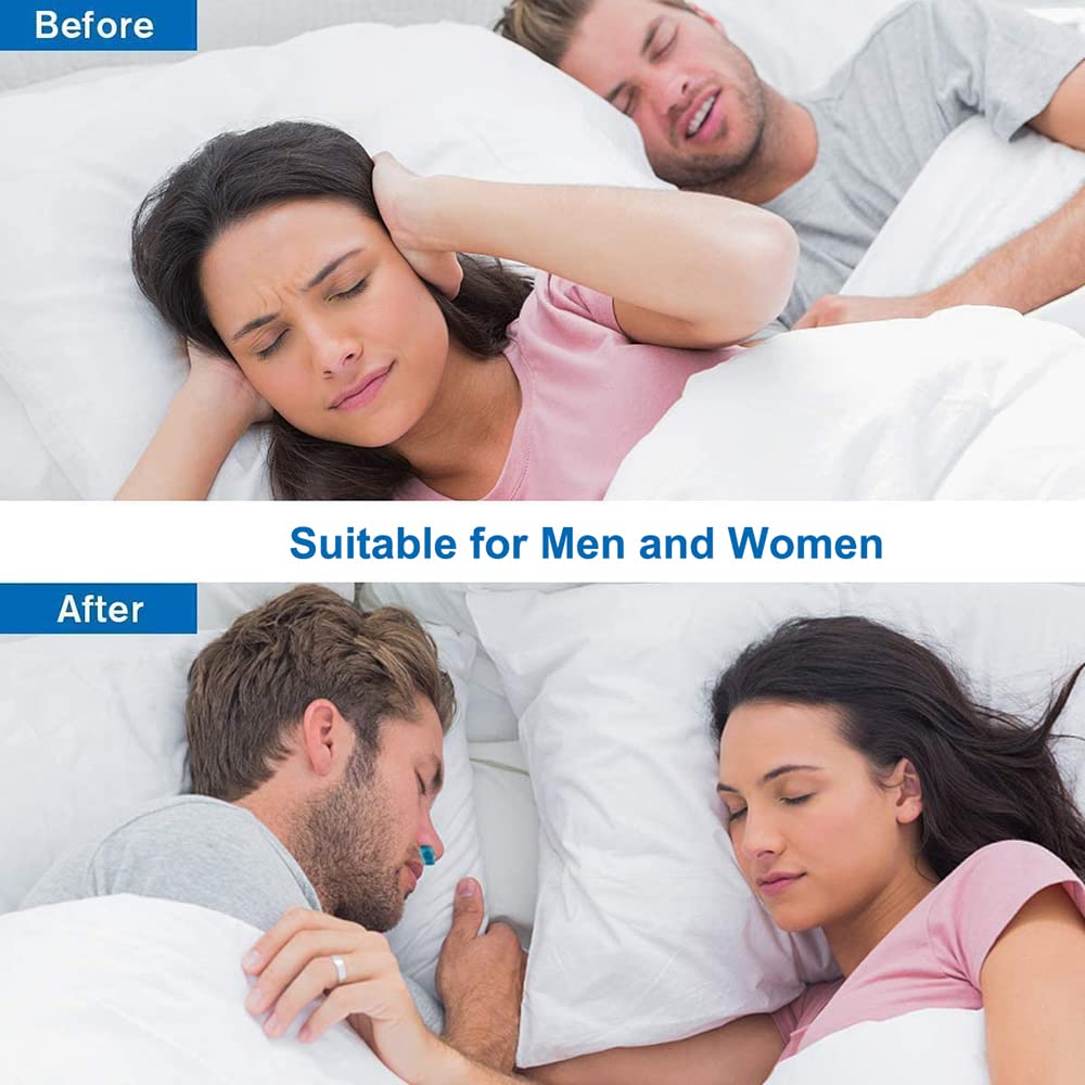 Anti Snoring Nose Clip - Stop Snoring Device for Men & Women | Comfortable Breathing Aid for Better Sleep | Air Purifier for Snoring Relief | Perfect for Travel, Home & Office Use