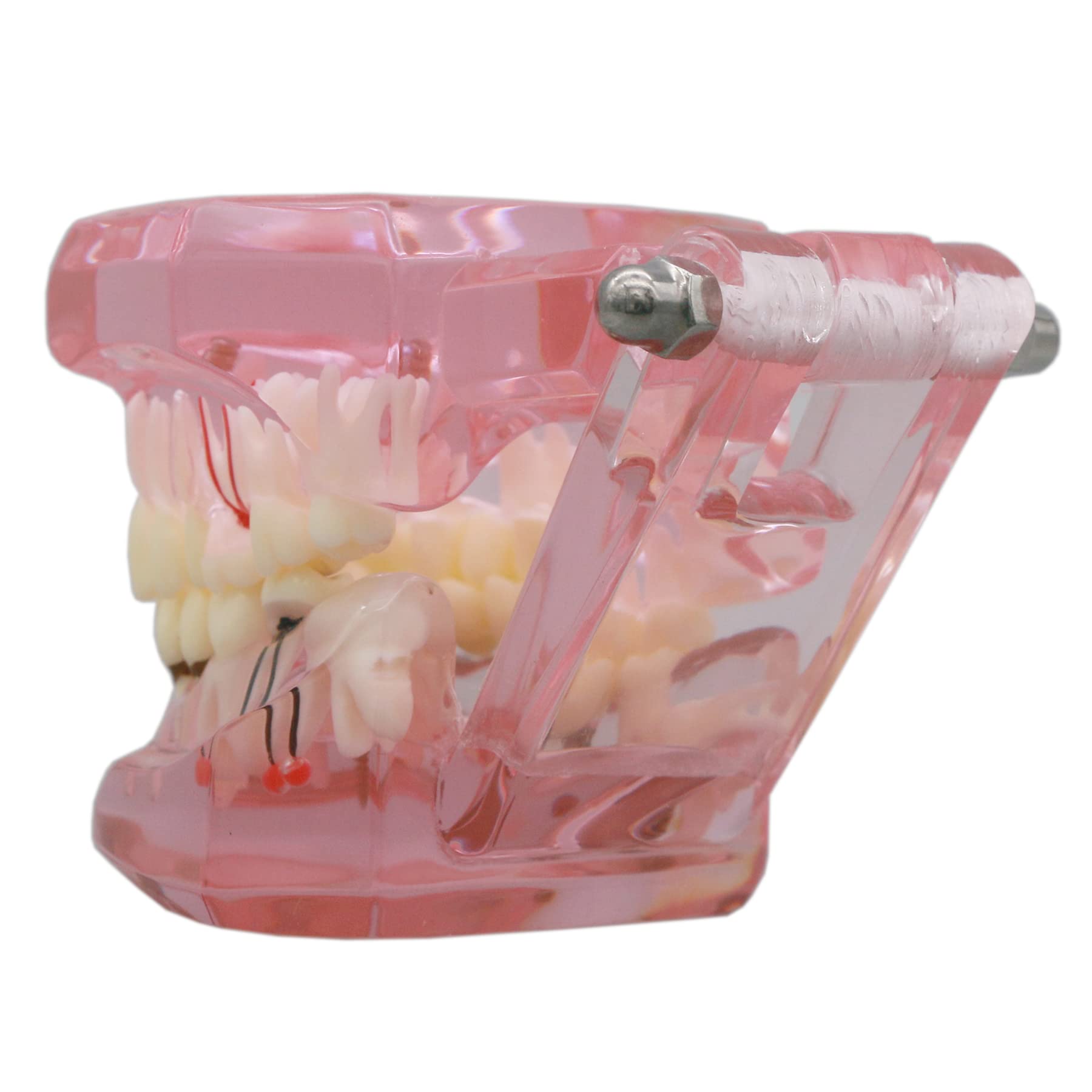 Dental Implant Typodont Model M2001 - Pink Oral Pathology Teeth for Dental Teaching, Study & Practice | Perfect for Dental Schools, Clinics & Training Demonstrations