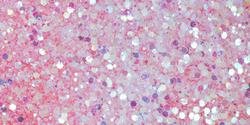 15ml Taffeta Pink Embossing Powder for Card Making, Scrapbooking & DIY Crafts - Heat Activated for Stunning Designs