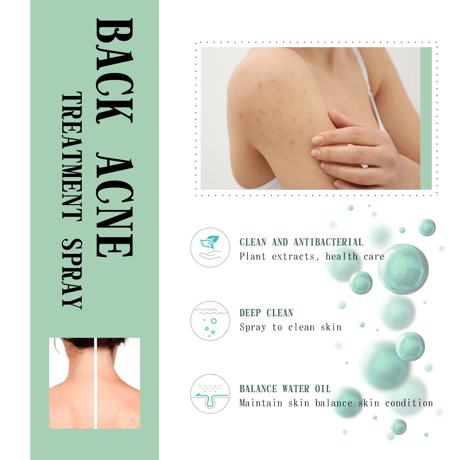2% Salicylic Acid Back Acne Spray Treatment with Tea Tree Oil & Herbal Formula - 4.05 oz Acne Solution for Teens & Adults | Clear Body Breakouts for Gym, Sports & Daily Use