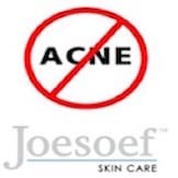 JOESOEF Sulfur Soap for Acne Treatment - 100g Facial Cleanser with Sulfur for Acne-Prone Skin (4-Pack) | Helps Clear Breakouts & Blackheads - Ideal for Daily Face Wash & Body Care