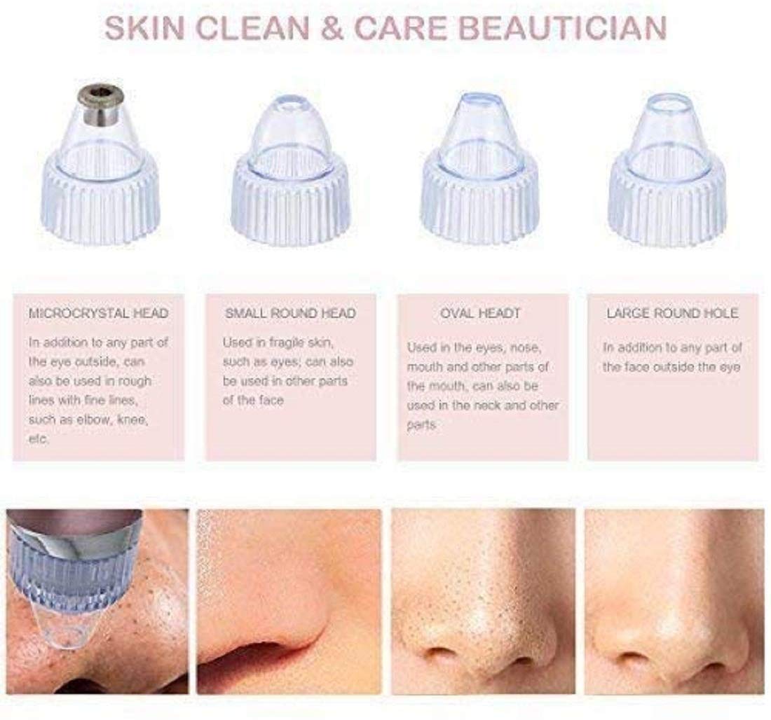 Heattack Baethan 4-in-1 Multi-Function Blackhead & Whitehead Remover Tool - Acne Pimple Extractor, Pore Cleaner & Skin Care Device for Men & Women - Perfect for Facial Cleansing & Acne Treatment at Home