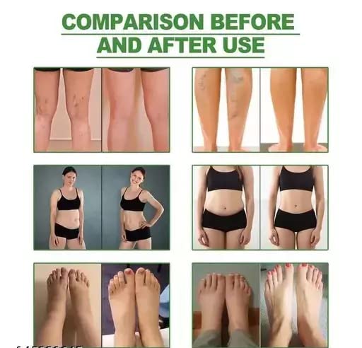 Organic Ginger Foot Detox Pads for Weight Loss & Toxin Removal - 10-Piece Pack (5 Pairs) - Natural Body Cleansing for Relaxation & Improved Sleep