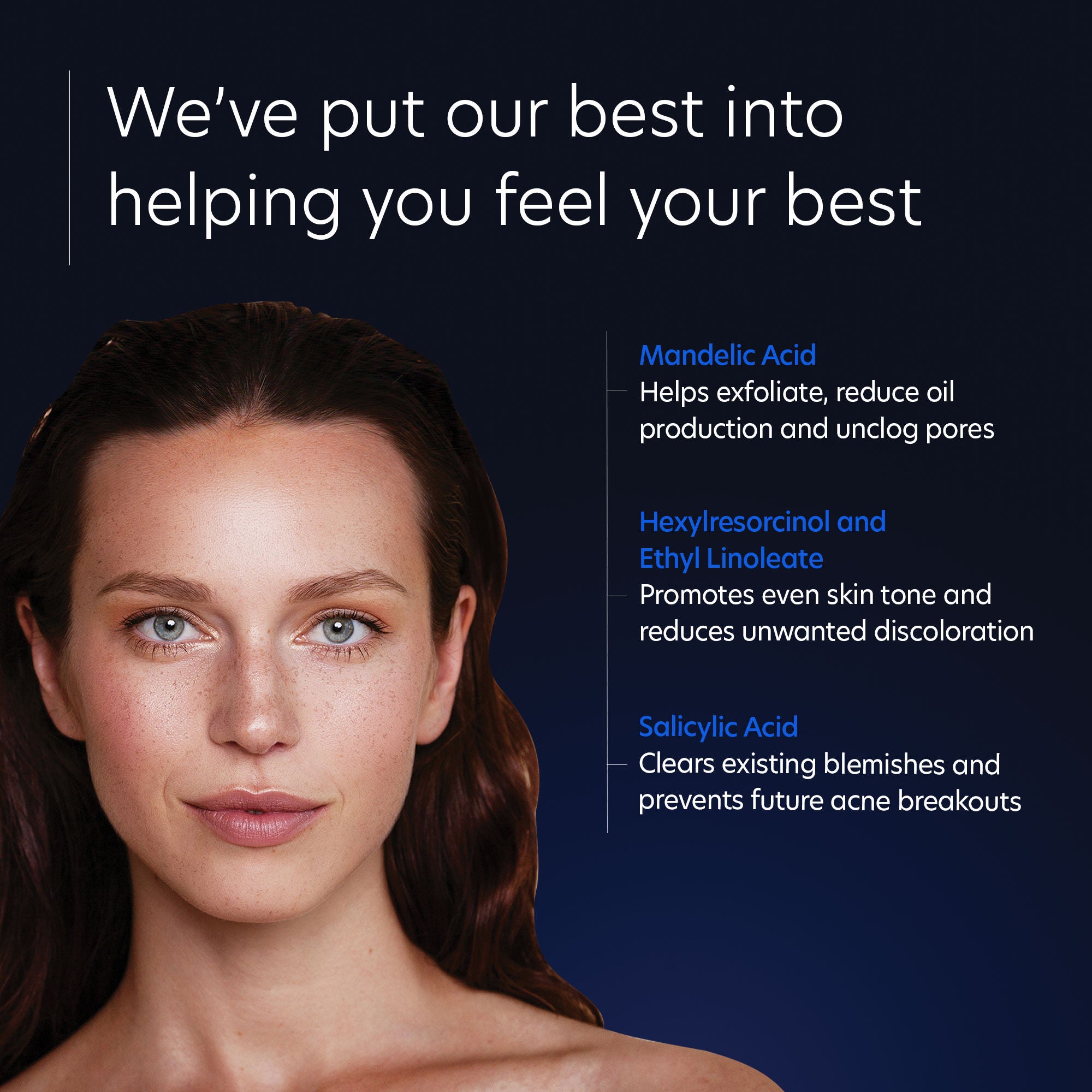 Best Acne Treatment Gel with OmniSome Technology - Clear Skin Fast for Teens & Adults | Perfect for Daily Skincare Routine & Breakout Control
