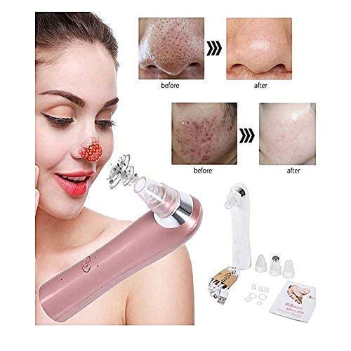 Nirva Electric Blackhead Remover - Pore Cleaner for Face Care