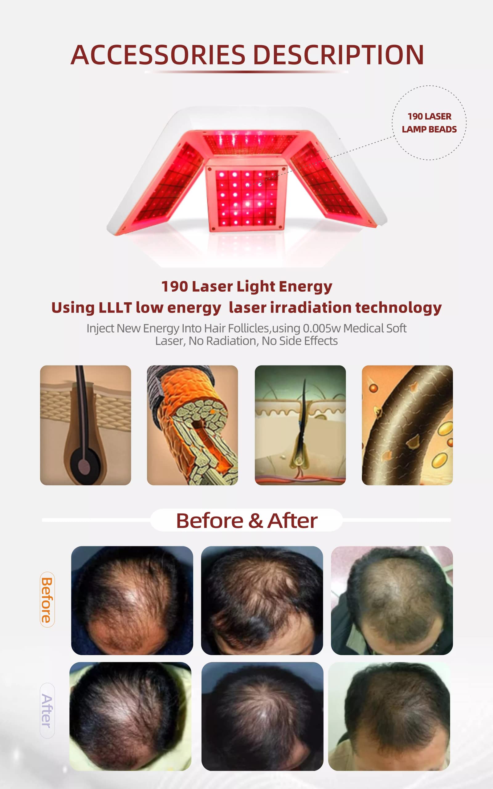 5 in 1 Multifunctional Hair Regrowth System for Men & Women - Anti Hair Loss Treatment with Laser Comb & Essential Oils - Stimulates Growth for Thinning Hair (Perfect for Home Use & Salon Treatments)