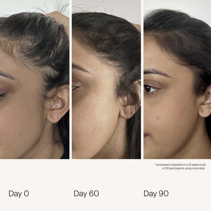Living Proof Scalp Care Density Serum for Hair Growth & Thickness - Volumizing Treatment for Thinning Hair - Use for Daily Scalp Massage & Healthy Hair Regimen