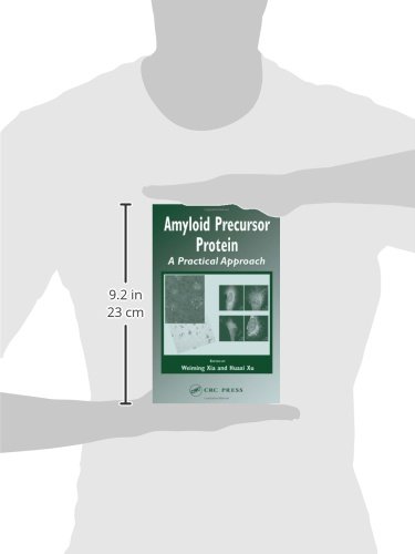Amyloid Precursor Protein (APP) Research Guide - Practical Approach for Alzheimer's Disease Studies | Neuroscience Lab Tools & Brain Research Applications