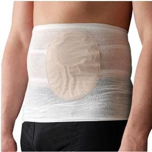CareFix StomaSafe 50000501 Classic Ostomy Support Belt - 3 Pack for Comfort & Security - Ideal for Post-Surgery Recovery & Active Lifestyle