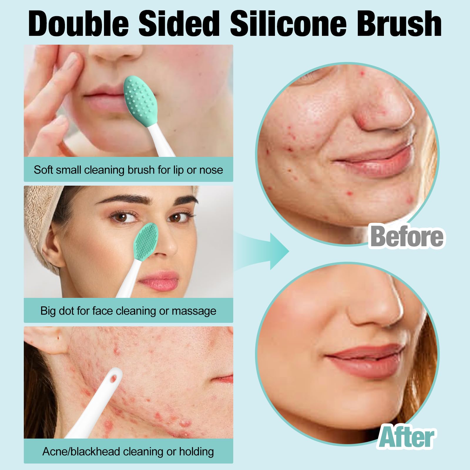 3Pcs Blackhead Remover Kit - Acne Treatment Tools for Face & Nose Care