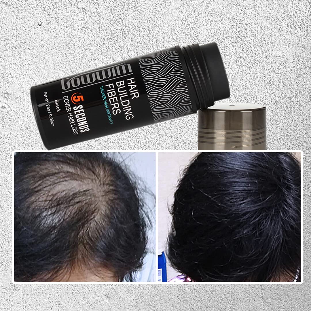 Gowwim Hair Building Fibers Powder for Thinning Hair & Baldness - Medium Brown | Natural-Looking Hair Thickener for Men & Women | Perfect for Daily Use, Special Occasions & Confidence Boosting