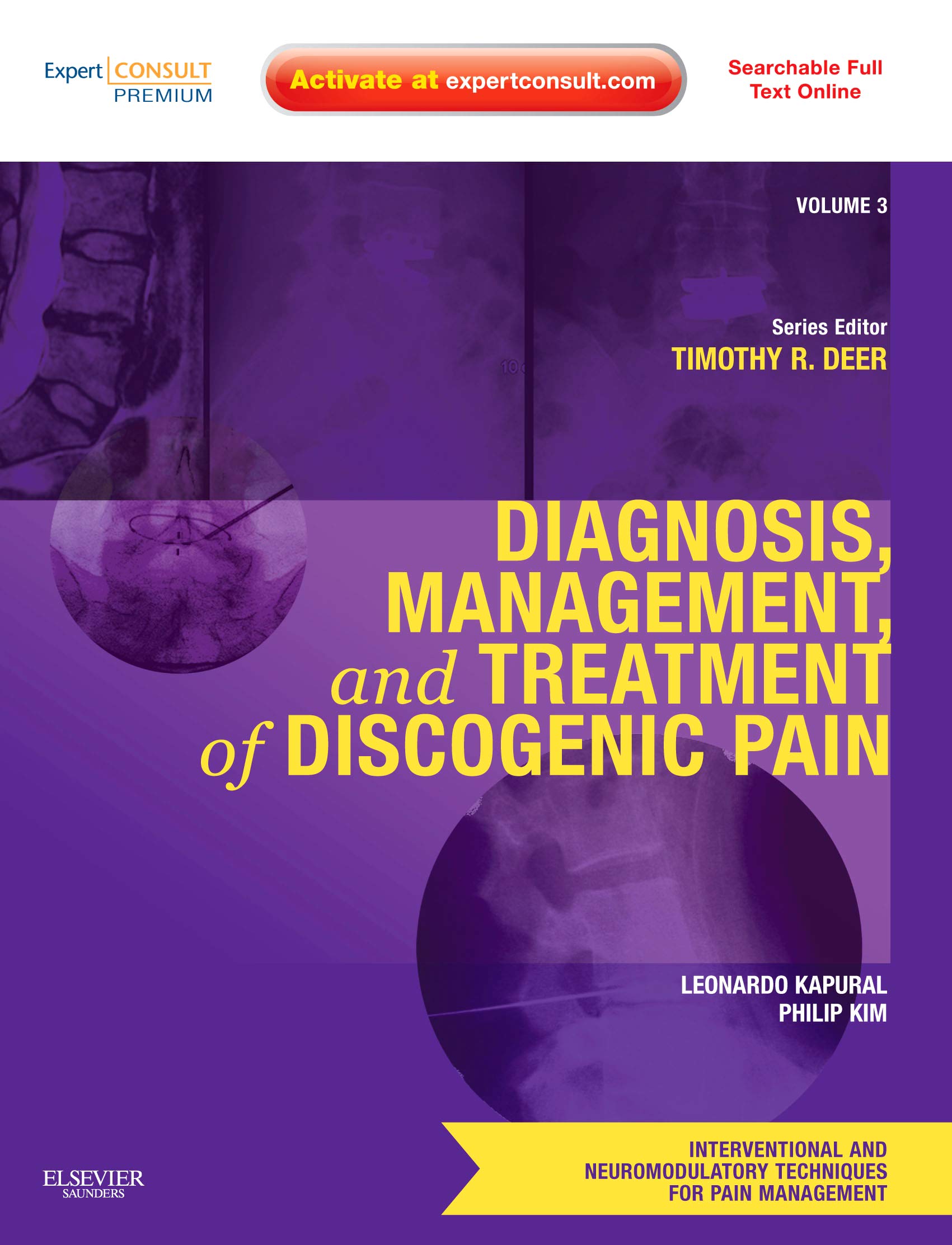 Diagnosis, Management & Treatment of Discogenic Pain - Volume 3: Interventional & Neuromodulatory Techniques for Pain Management | Comprehensive Guide for Medical Professionals & Pain Specialists | Clinical Reference for Back Pain Therapy