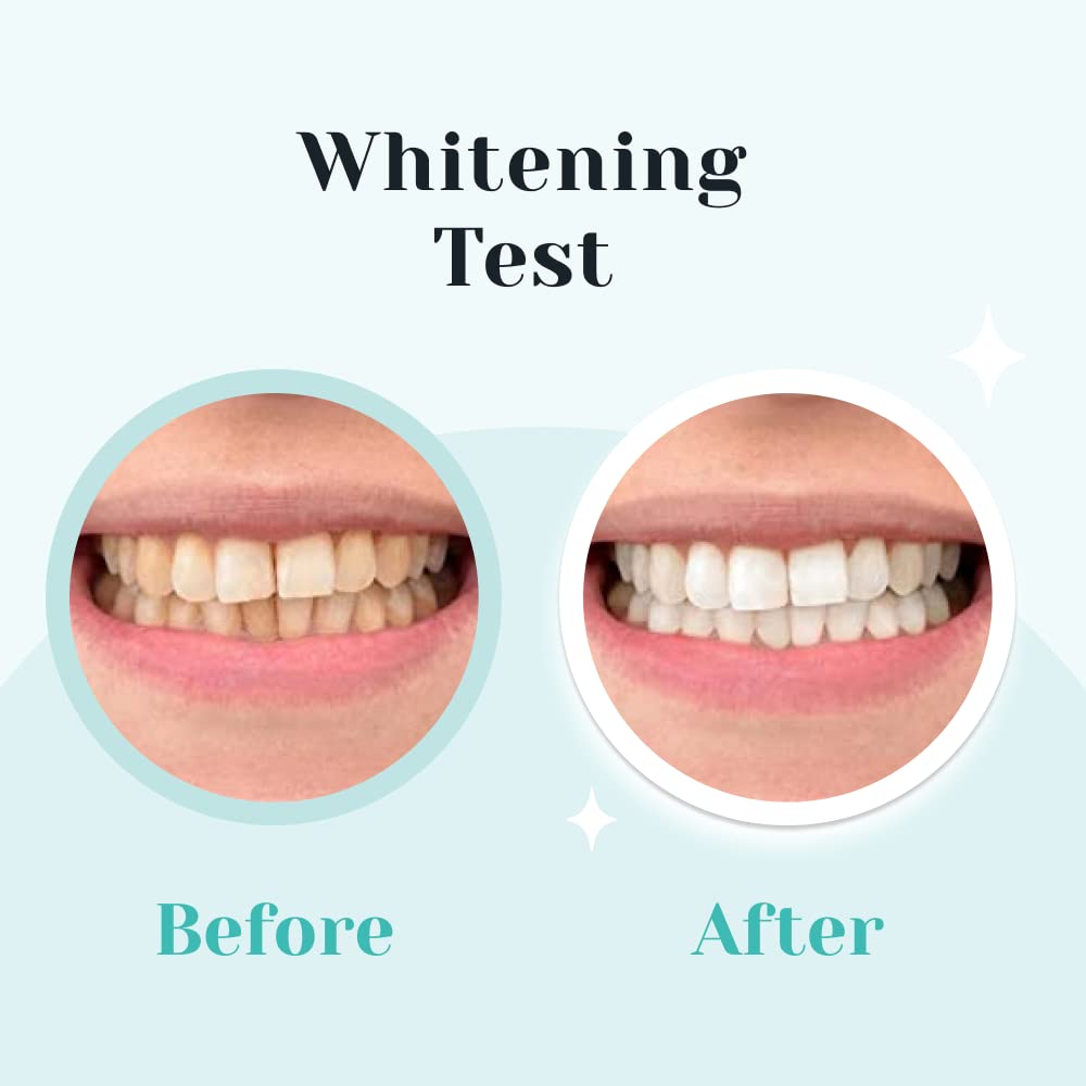 Autobrush LED Teeth Whitening Kit - Complete Home Whitening System with 30 Treatments (White) | Professional Dental Care for Brighter Smile at Home, Travel & Special Occasions