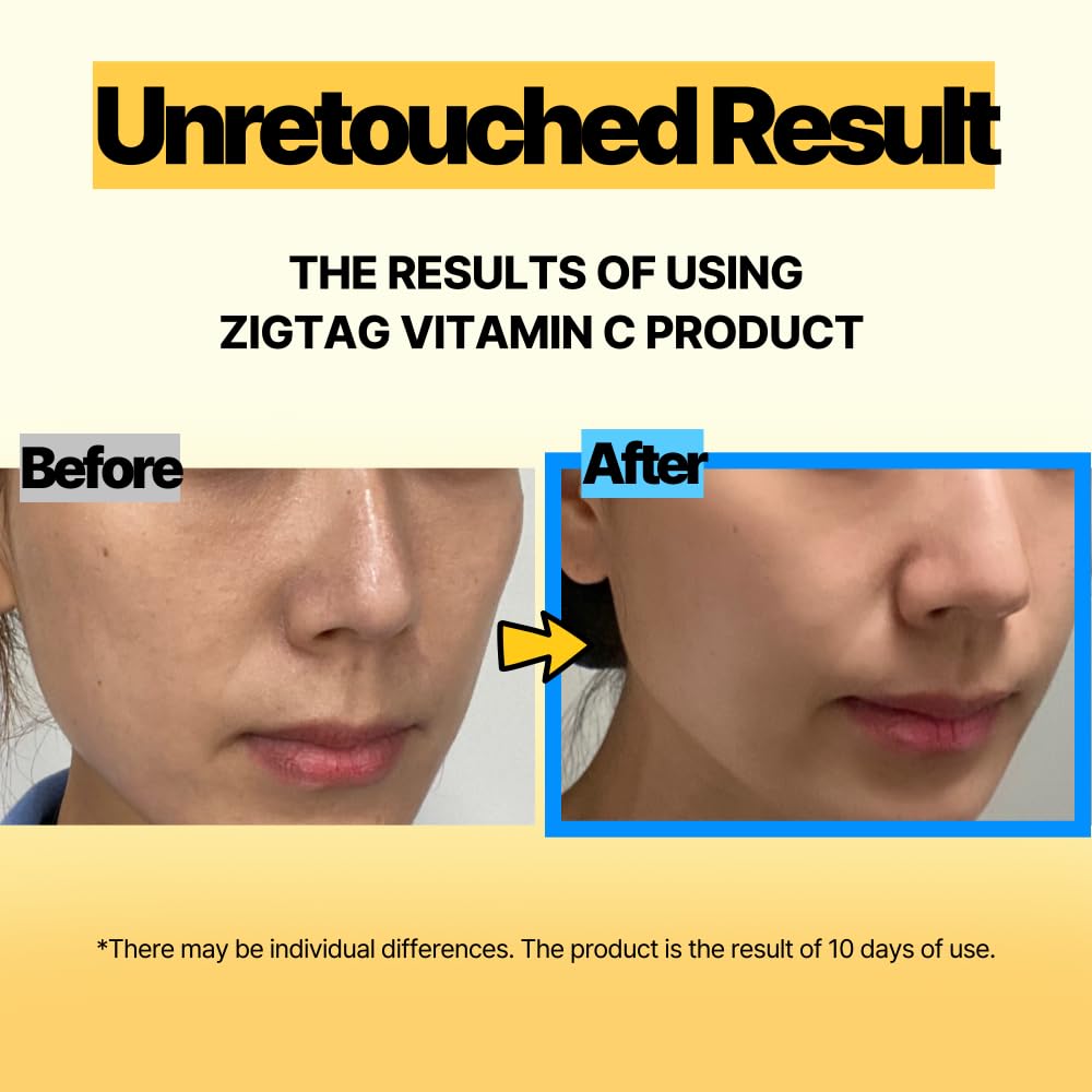 Vitamin C 15% Super Blast Ampoule - Korean Skin Brightening Serum with Glutathione & Ferulic Acid | Anti-Aging Treatment to Reduce Wrinkles & Even Skin Tone | Brightening Facial Serum for Radiant & Youthful Skin | 24ml/0.81Oz | Perfect for Night Routine & Daily Skincare