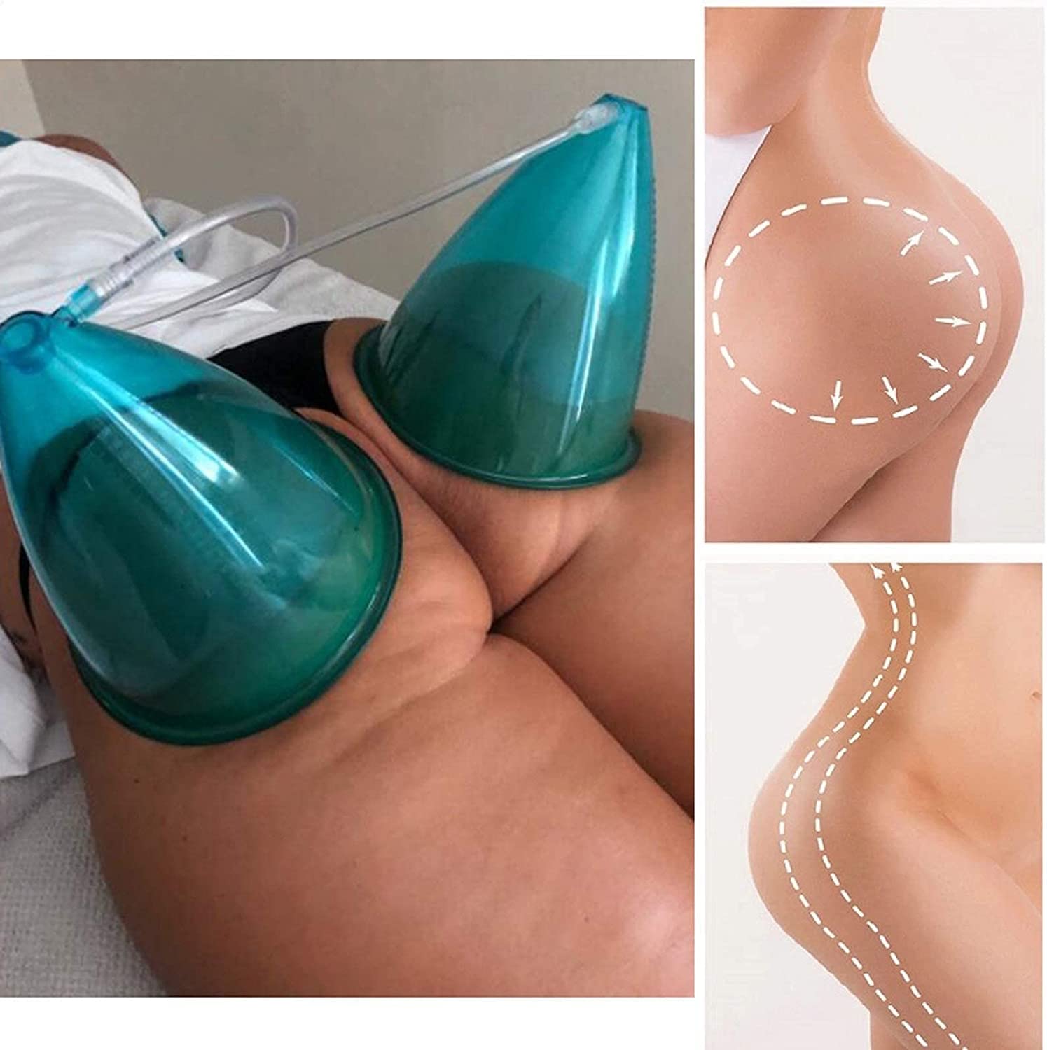 Premium XL Buttock Vacuum Cups 180ml - Professional Butt Lifting & Body Cupping Therapy Accessories for Home Spa, Massage, and Body Contouring