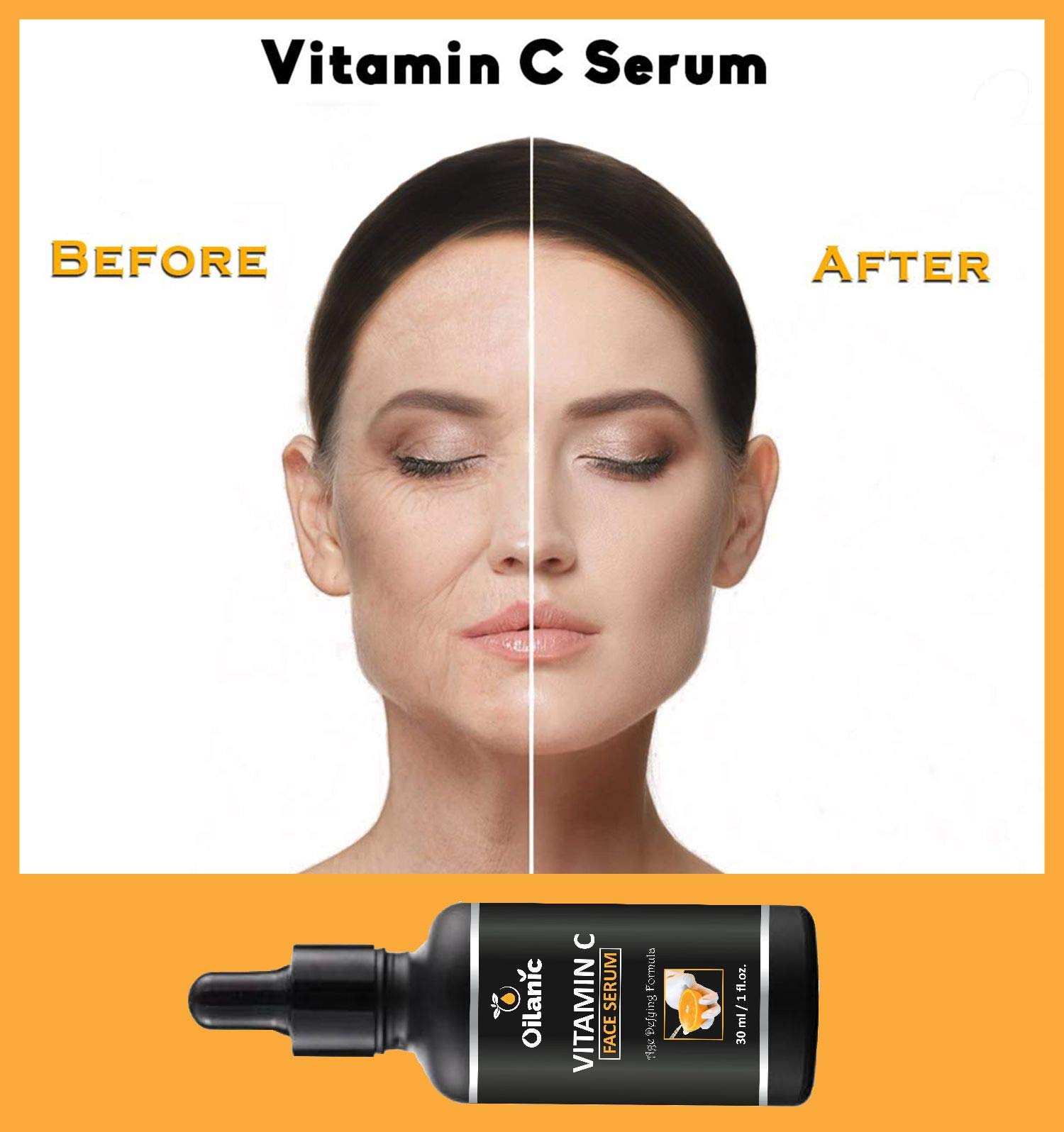 Oilanic Vitamin C Face Serum 30ml - Dark Spot Corrector & Anti-Wrinkle Treatment for Glowing Skin | Hydrating & Brightening Facial Serum for Women & Men | Acne Scar Repair & Skin Moisturizer | Day & Night Use for Radiant Complexion