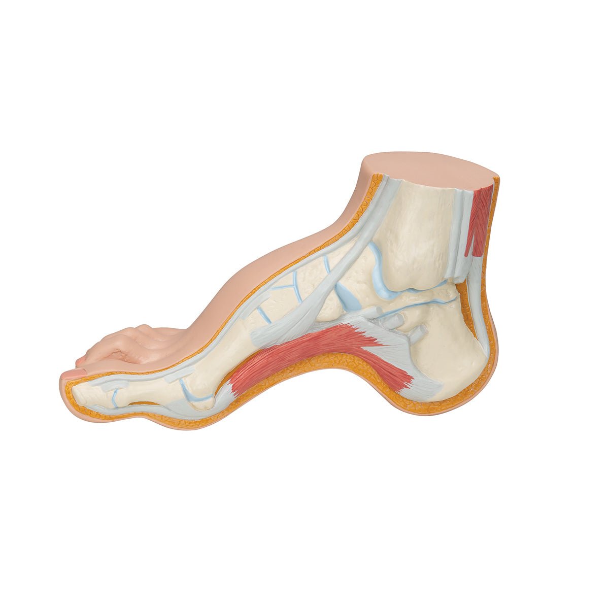 Best Orthotic Insoles for Hollow Foot (Pes Cavus) - High Arch Support for Pain Relief - Perfect for Running, Walking & Standing All Day
