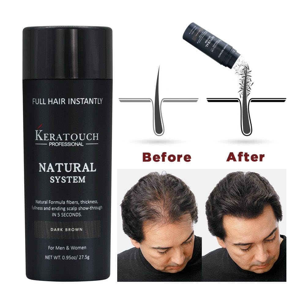 KERATOUCH Hair Building Fibers for Thinning Hair & Bald Spots - Natural Keratin Hair Fibers for Men & Women (Brown, 27.5g) - Instant Hair Volume Solution for Daily Styling & Confidence Boost