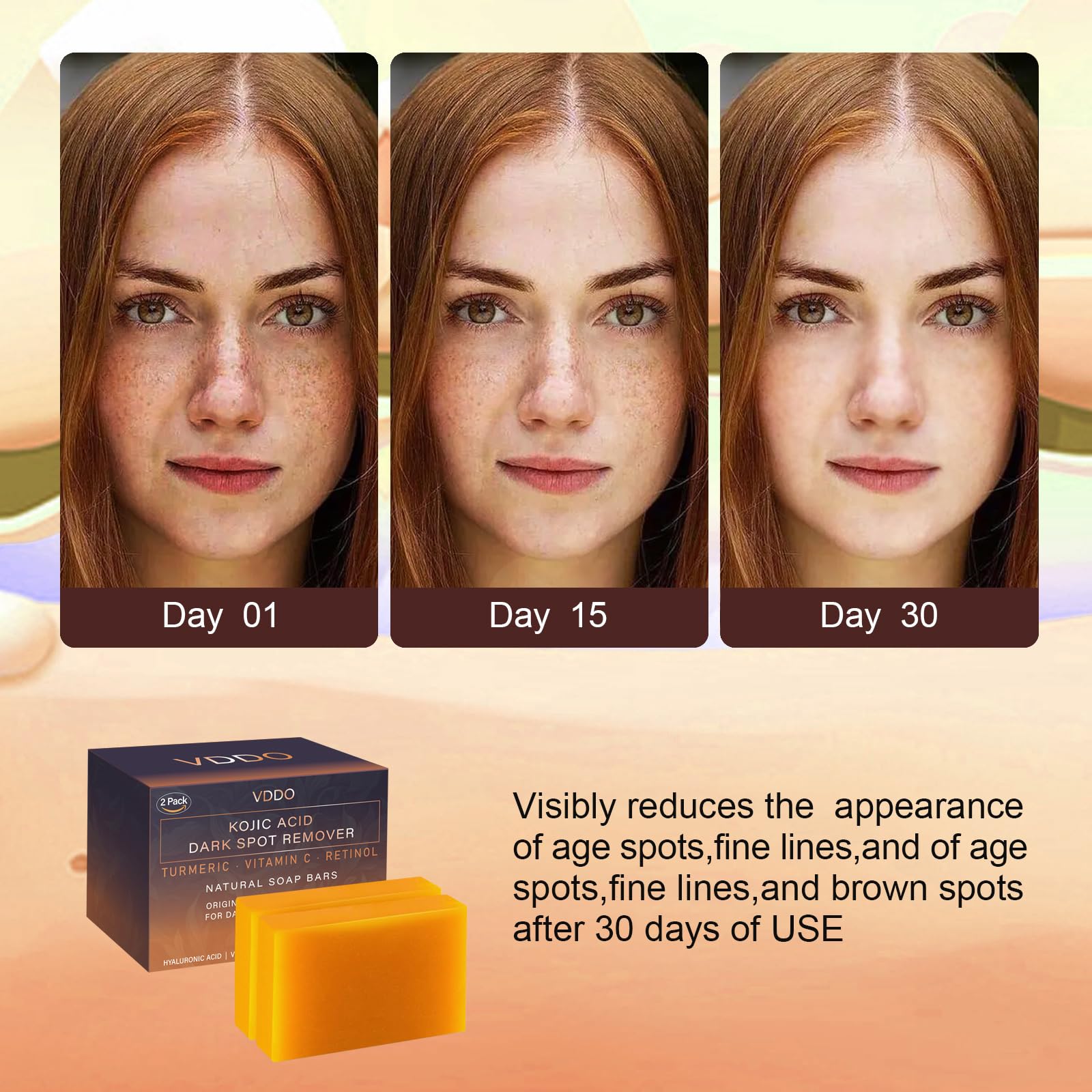 Turmeric & Kojic Acid Soap Bar for Dark Spots & Hyperpigmentation - Japanese Formula with Retinol, Vitamin C, Collagen & Hyaluronic Acid - Brightening Face & Body Soap for Even Skin Tone - Perfect for Daily Skincare & Acne Treatment