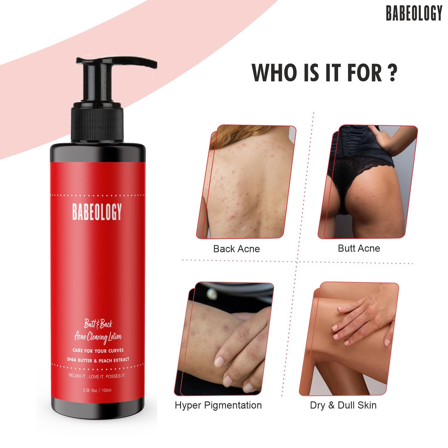 Babeology Back and Bum Acne Clearing Lotion 100ml - Butt Acne Treatment & Dark Spot Removal Cream with Shea Butter & Peach Extract | Effective Scar Fading & Skin Brightening | Perfect for Body Acne, Blemish Care & Smooth Skin Routine