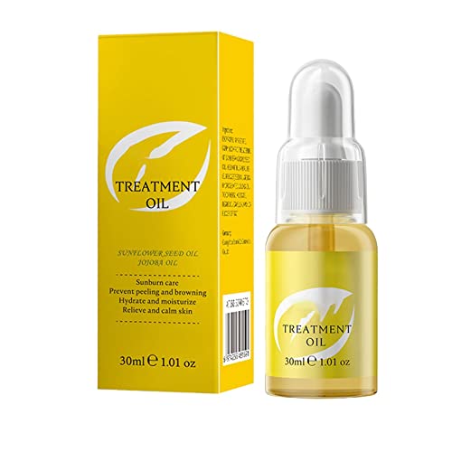Natural After Sun Lotion with Soothing Oils for Sunburn Relief - 30ml Hydrating Body Lotion for Post-Sun Care & Acne-Prone Skin | Perfect for Beach Days, Poolside Recovery & Summer Skincare