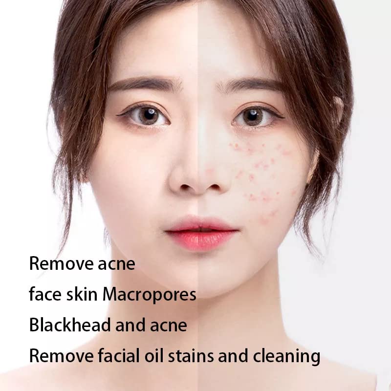 Oil Absorbing Sheets for Face - 100 Pack | Blotting Paper for Oily Skin, Blackhead Control & Makeup Touch Up | Men & Women | Portable Oil Control Film for On-the-Go Use - Gym, Office & Travel Essentials