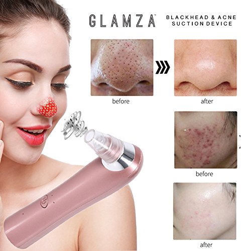 Glamza Electric Blackhead Remover Vacuum - Pore Cleaner for Face & Nose, Acne Extractor Tool with Suction Technology for Deep Cleansing | Perfect for Daily Skincare Routine & Spa Treatment at Home
