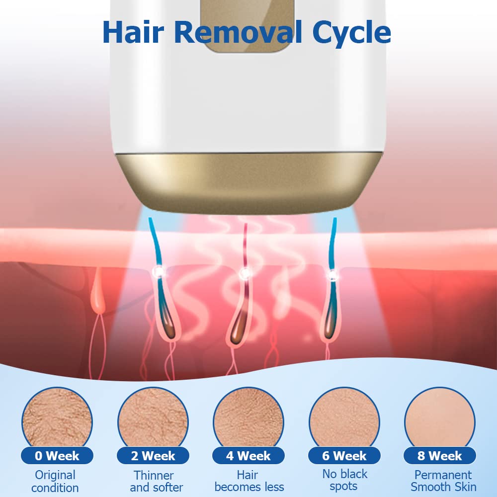 IPL Hair Removal Device for Women & Men - 999,999 Flashes Permanent Hair Removal System for Full Body - At-Home Use for Smooth Skin - Gold (Ideal for Legs, Underarms, Bikini Line & Facial Hair)