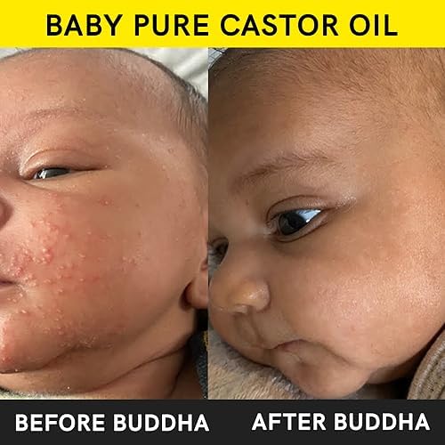 Organic Cold-Pressed Extra Virgin Castor Oil for Babies - Natural Nourishing & Moisturizing Treatment for Delicate Skin & Hair Growth - Chemical-Free, 150ml - Perfect for Baby Massage, Eczema Relief & Cradle Cap Care