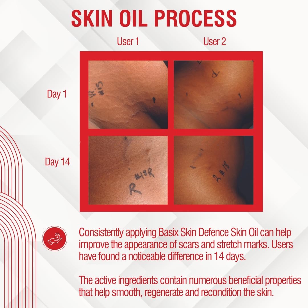 Basix Skin Defence Clear Skin Tissue Oil for Stretch Marks, Scars & Uneven Skin Tone - Tamanu, Argan, Grapeseed, Jojoba, Rosehip & Calendula Oils - Perfect for Post-Pregnancy, Weight Loss & Daily Skin Repair
