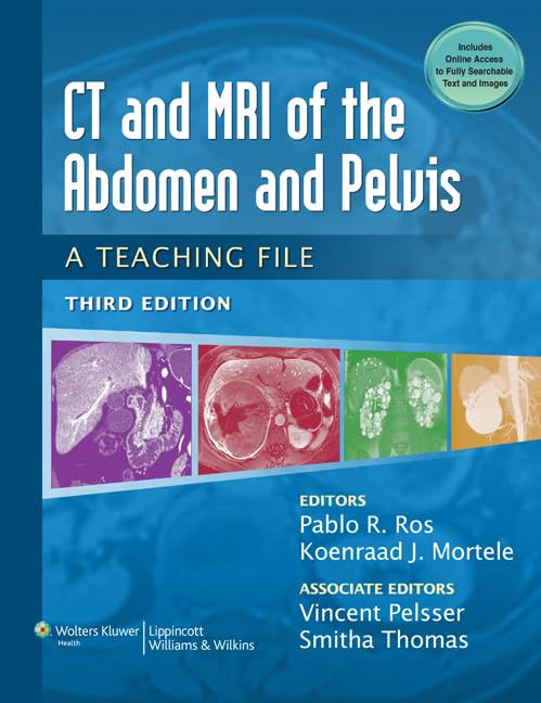 CT & MRI of the Abdomen and Pelvis: Comprehensive Teaching File for Radiology Education - LWW Teaching File Series | Ideal for Medical Students, Residents, and Radiologists Learning Abdominal Imaging Techniques
