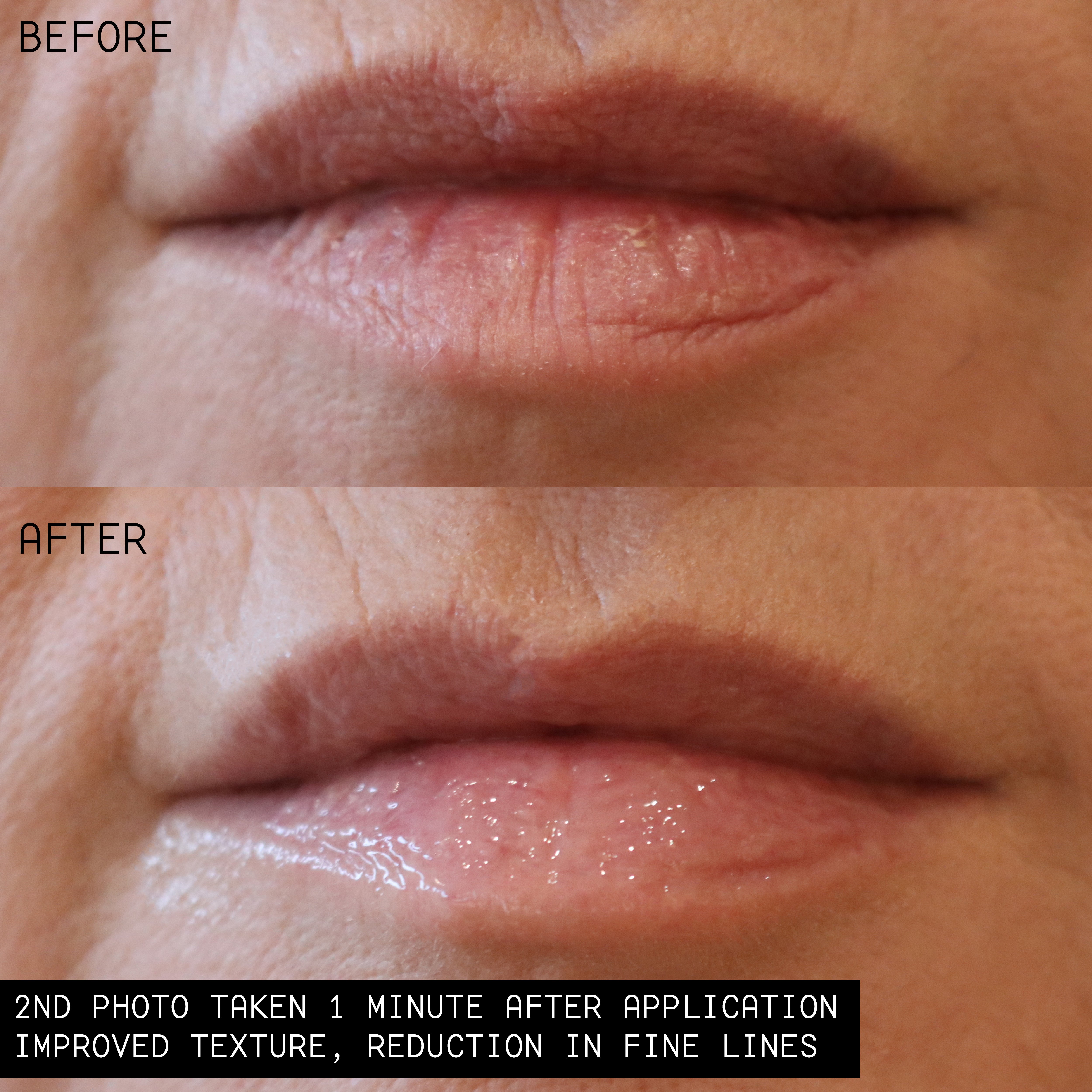 Hydrating Lip Balm Ointment for Dry, Chapped Lips - Moisturizing Lip Treatment with Natural Ingredients - Perfect for Winter, Cold Weather & Daily Lip Care