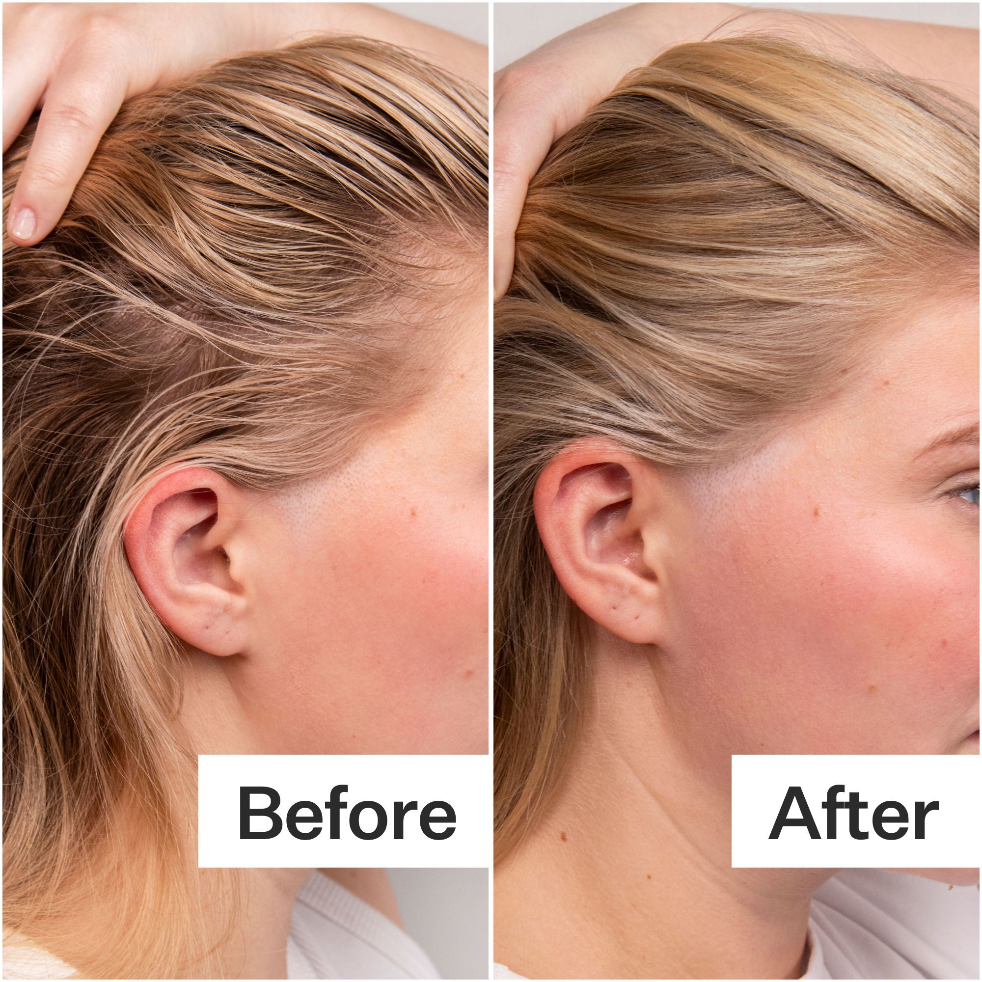 4% Niacinamide Scalp Serum for Oily Hair - Reduce Excess Oil & Soothe Irritation - Perfect for Daily Scalp Care & Hair Growth
