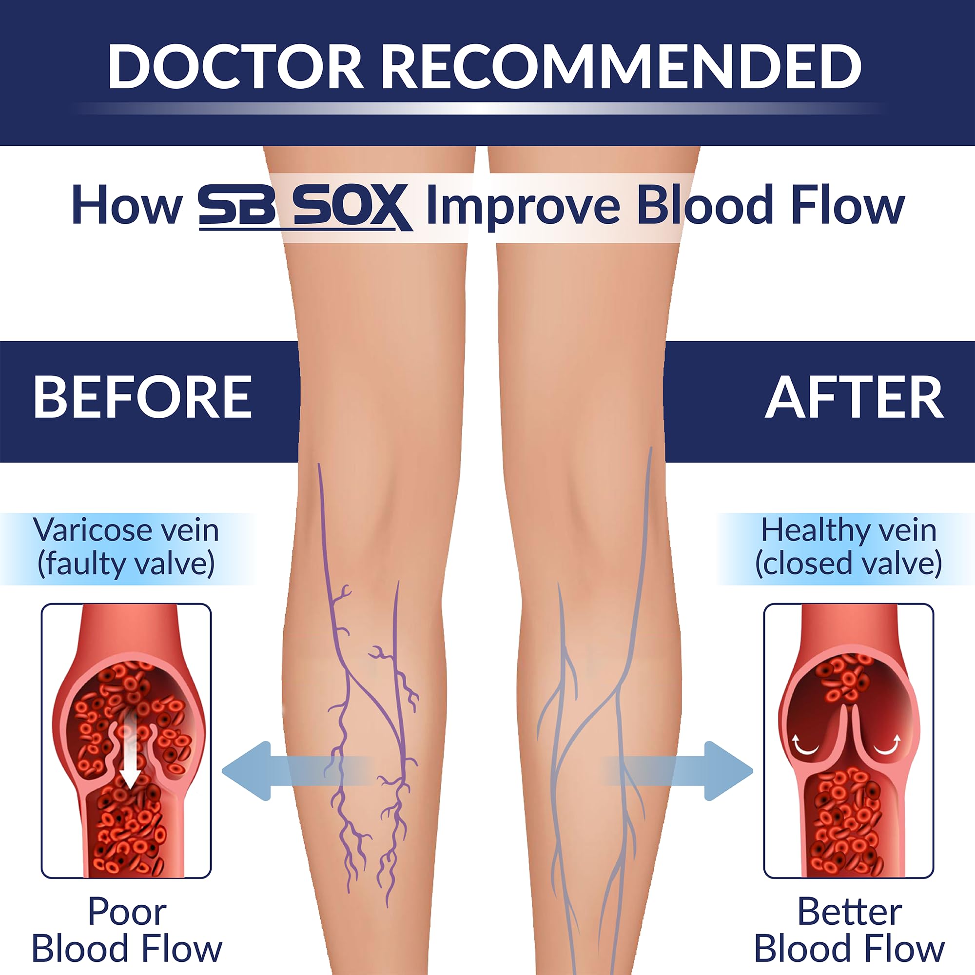 SB SOX Lite Compression Socks for Men & Women (15-20mmHg) – Best Graduated Compression Socks for Travel, Running, Nursing & Everyday Use - Improves Circulation & Reduces Swelling - Perfect for Athletes, Travelers & Professionals - Available in XXL Sizes
