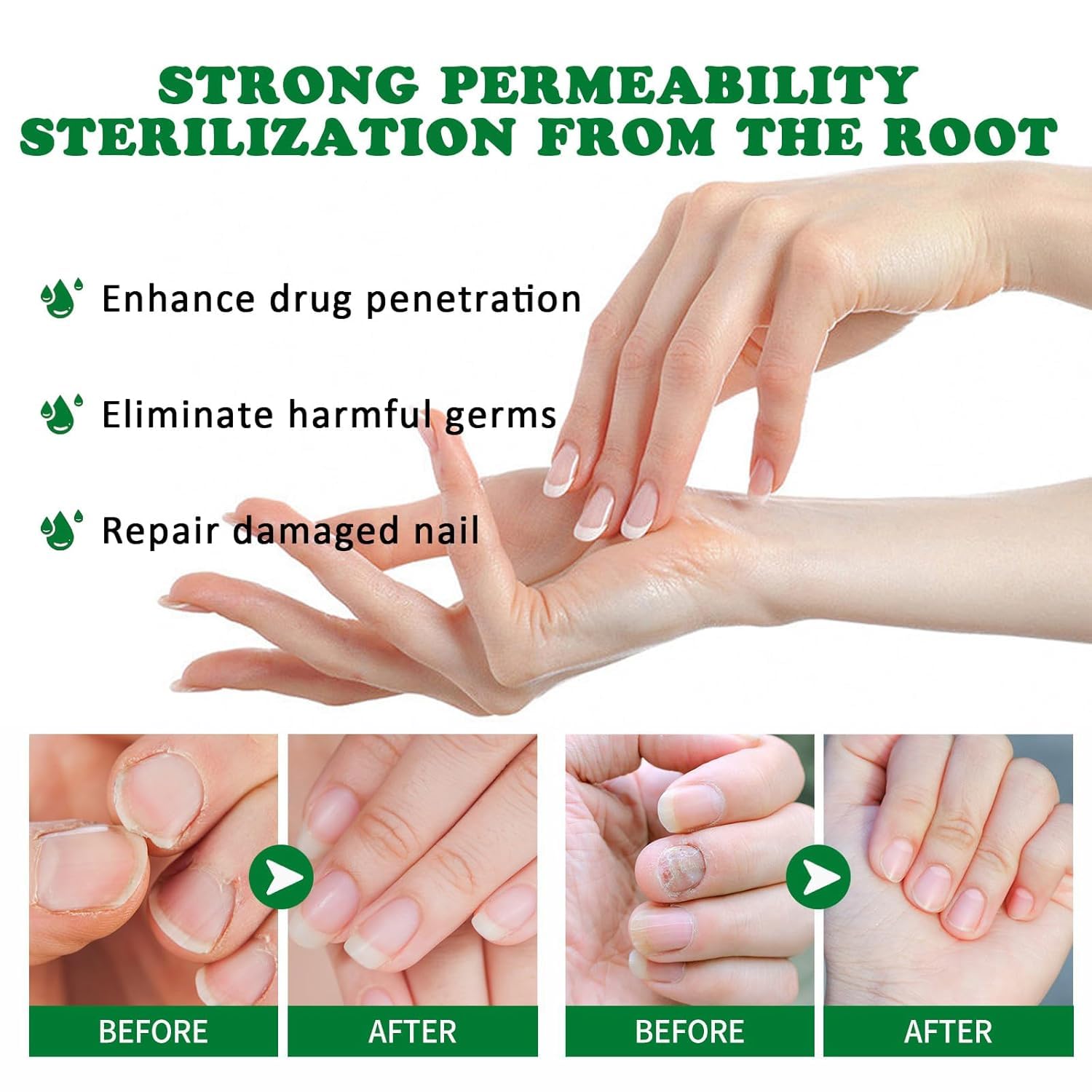7 DAYS Ginger Foot Spray & Nail Repair Treatment - Strengthening Cuticle Care Oil for Healthy Nails (30ml) - Ideal for Dry Feet, Cracked Heels & Brittle Nails at Home or Salon