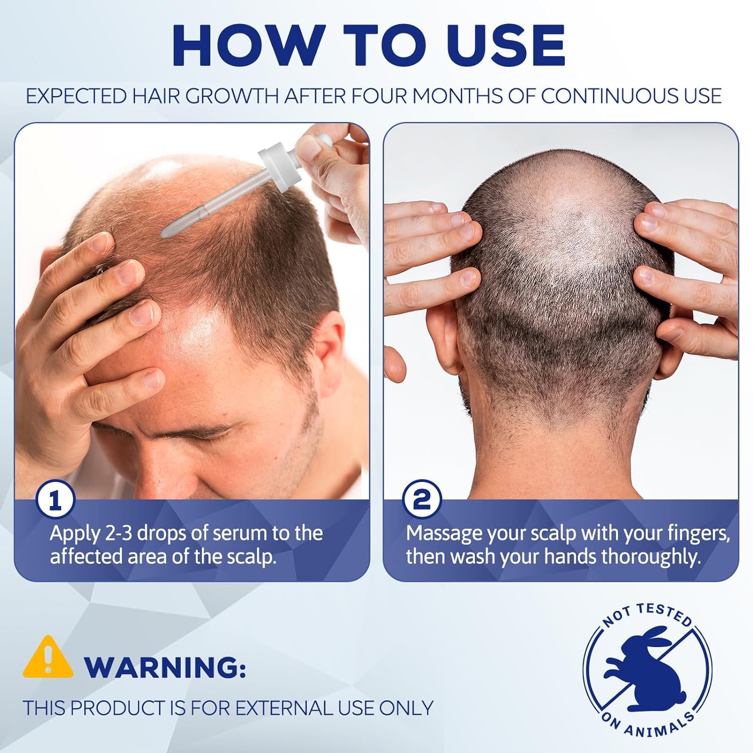 5% Minoxidil for Men & Women - Hair Growth & Beard Growth Treatment - Combat Thinning Hair & Hereditary Hair Loss - Effective for Hair Regrowth & Thicker Hair - Perfect for Daily Use at Home or Salon