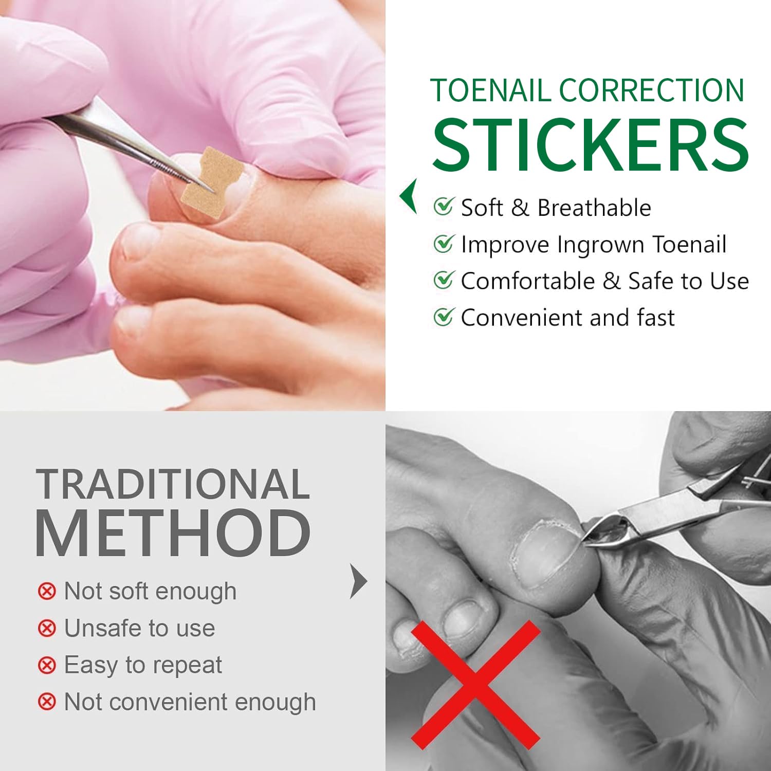 50 Pcs Ingrown Toenail Corrector Patches - No Glue Breathable & Painless Nail Correction Treatment, Stays on Securely for Quick Repair | Ideal for Athletes, Runners & Daily Comfort