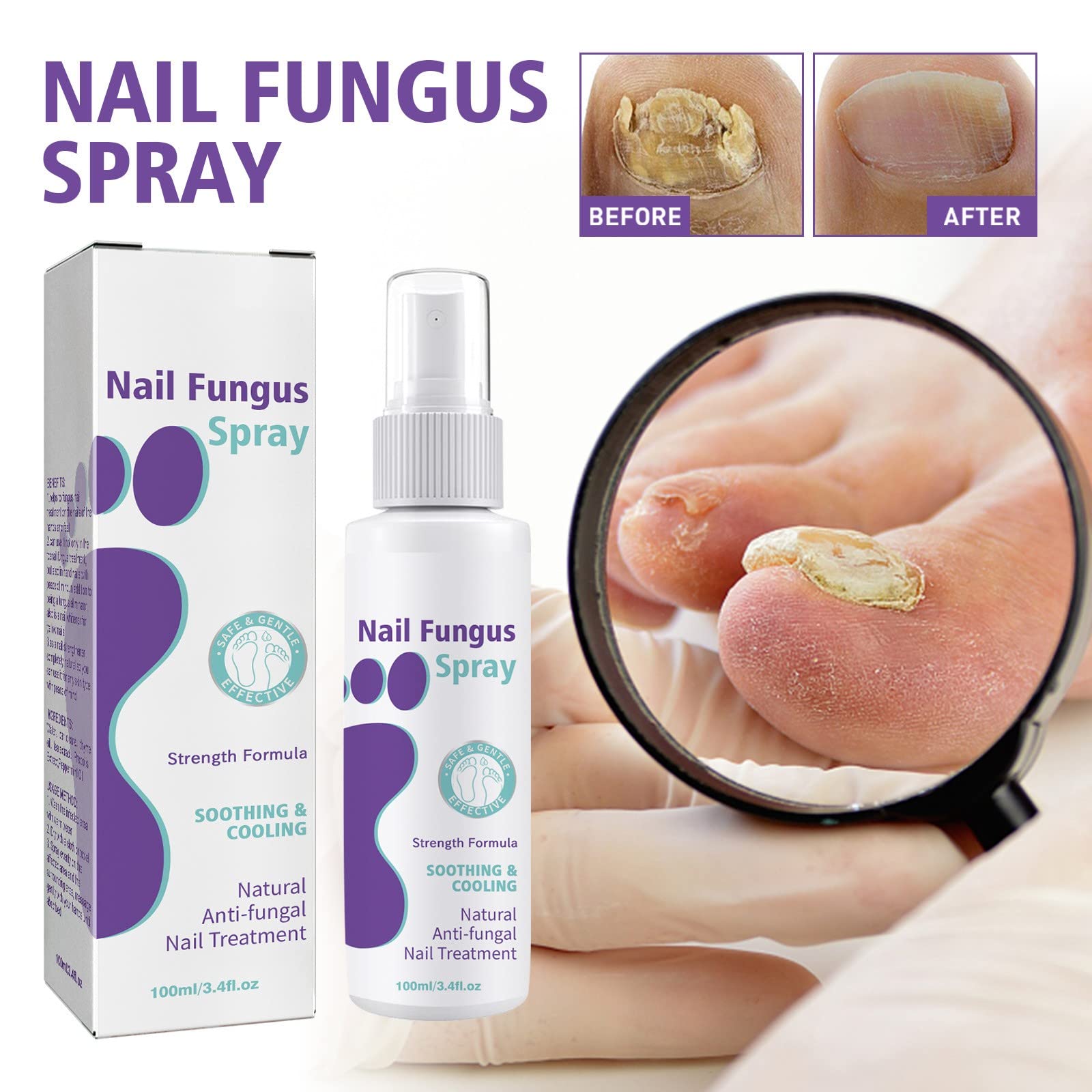 Nail Repair Essence & Treatment - Maximum Strength Nail Solution for Discolored & Damaged Nails - Restores & Strengthens Nails Fast - Perfect for Manicures, Pedicures & Nail Care Routines