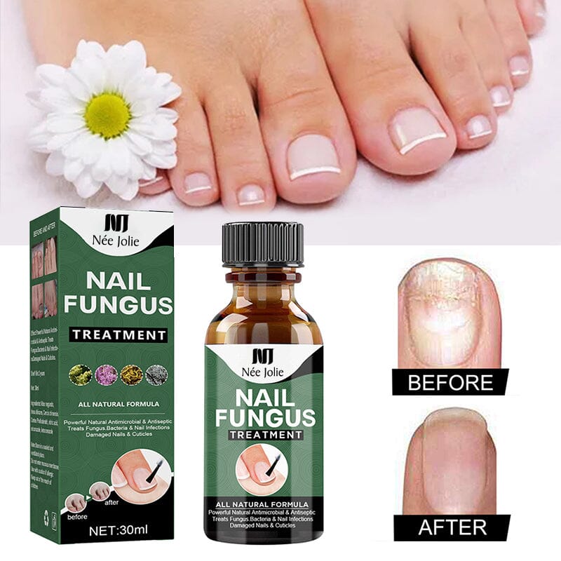 NEE JOLIE Nail Fungus Treatment Liquid - Effective Antifungal Solution for Toenail & Fingernail Fungus - Perfect for Home Use & Salon Treatments