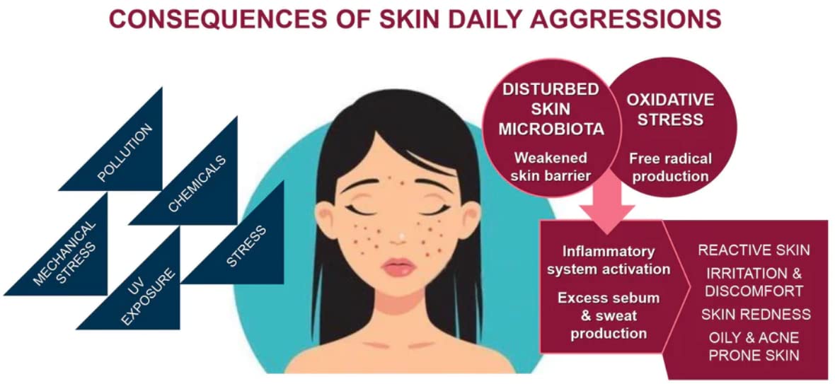 UBÂVA-AA Anti Acne Face Serum - Vegan & Cosmos Certified, 100% Natural Canadian Willowherb™ with AstraForce, Perfection Peptide P7 & 2% Salicylic Acid - Clear Skin Treatment for Acne-Prone & Sensitive Skin - Perfect for Daily Skincare Routine & Blemish Control