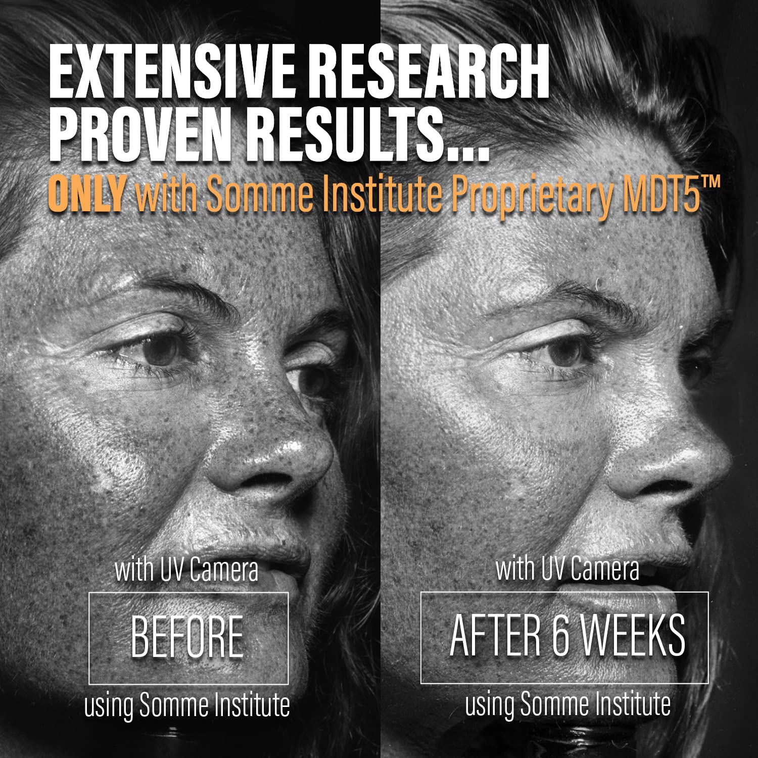 Pore Minimizer Face Mask - Detoxifying & Anti-Aging Clay Mask for Acne Prone Skin | Natural Skincare with Deep Hydration | Perfect for Oily Skin & Blackhead Removal at Home Spa