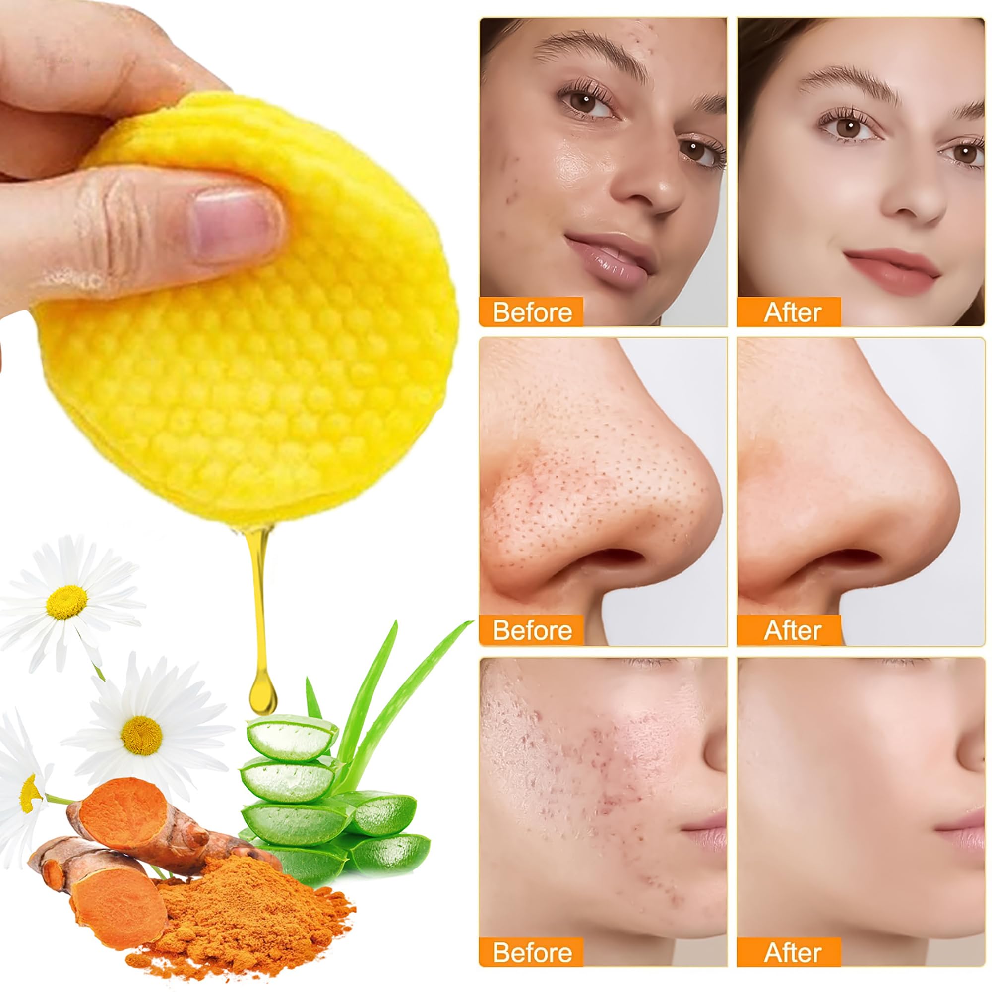 Kojic Acid & Turmeric Cleansing Pads - 50 Count Exfoliating Face Pads for Brightening Skin, Oil Control & Pore Refinement - Gentle Facial Exfoliator for Acne-Prone & Dull Skin - Perfect for Daily Skincare Routine & Travel