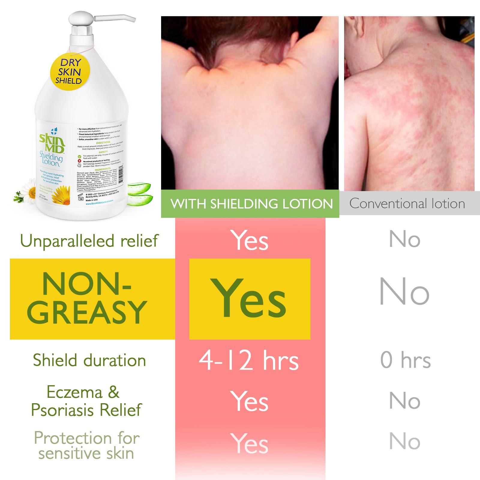 Skin MD Shielding Lotion - Hydrating Body Lotion for Sensitive Skin | Non-Greasy, Fast-Absorbing Moisturizer with Plant-Based Ingredients | Lotion for Dry Skin, Eczema & Psoriasis Relief (1 Gallon) | Perfect for Daily Use, Post-Shower Hydration & Skin Therapy