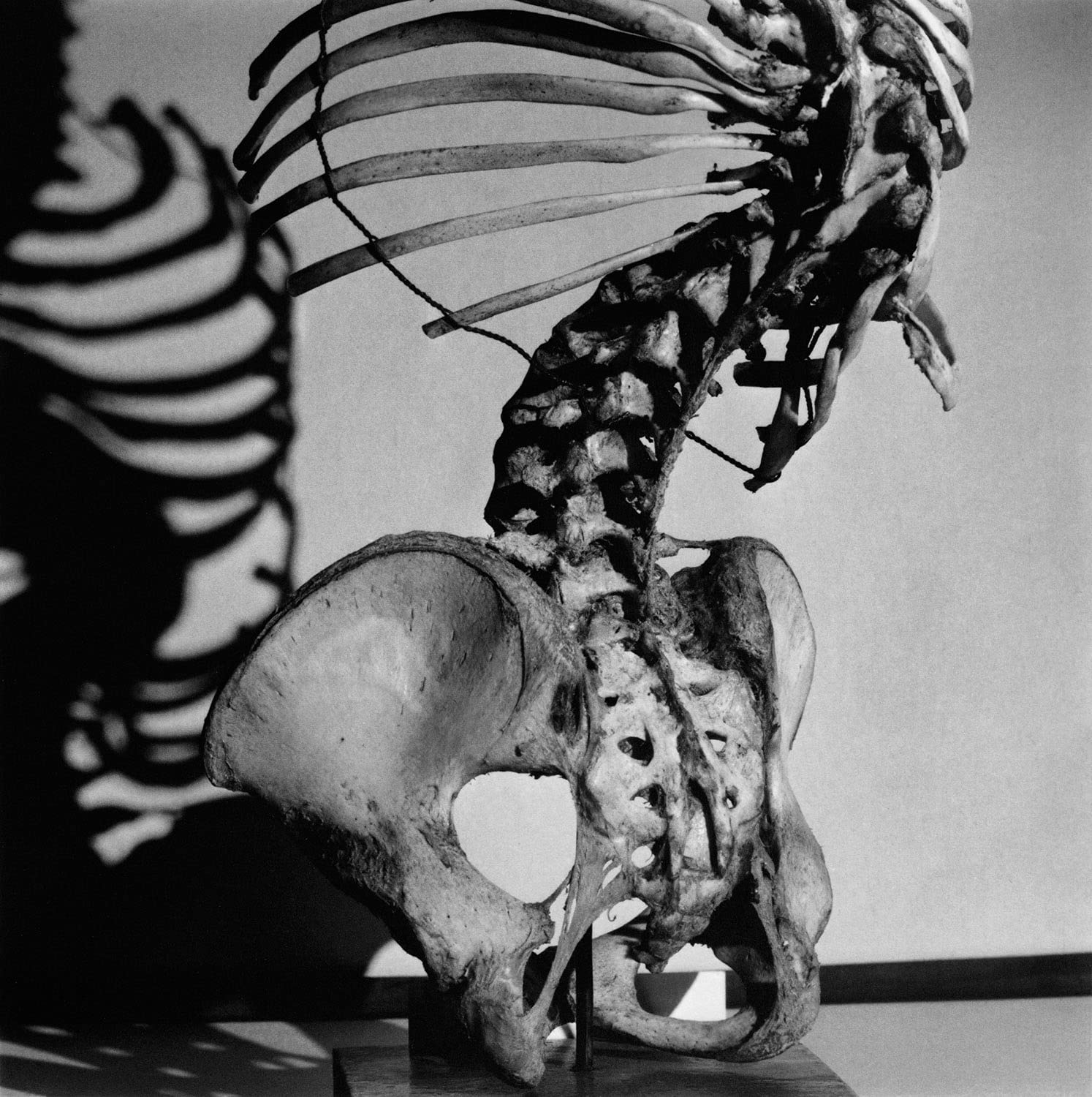 Diana Michener: Bones - Fine Art Photography Book for Collectors | Black & White Portraiture | Perfect for Art Lovers, Photography Enthusiasts & Home Decor