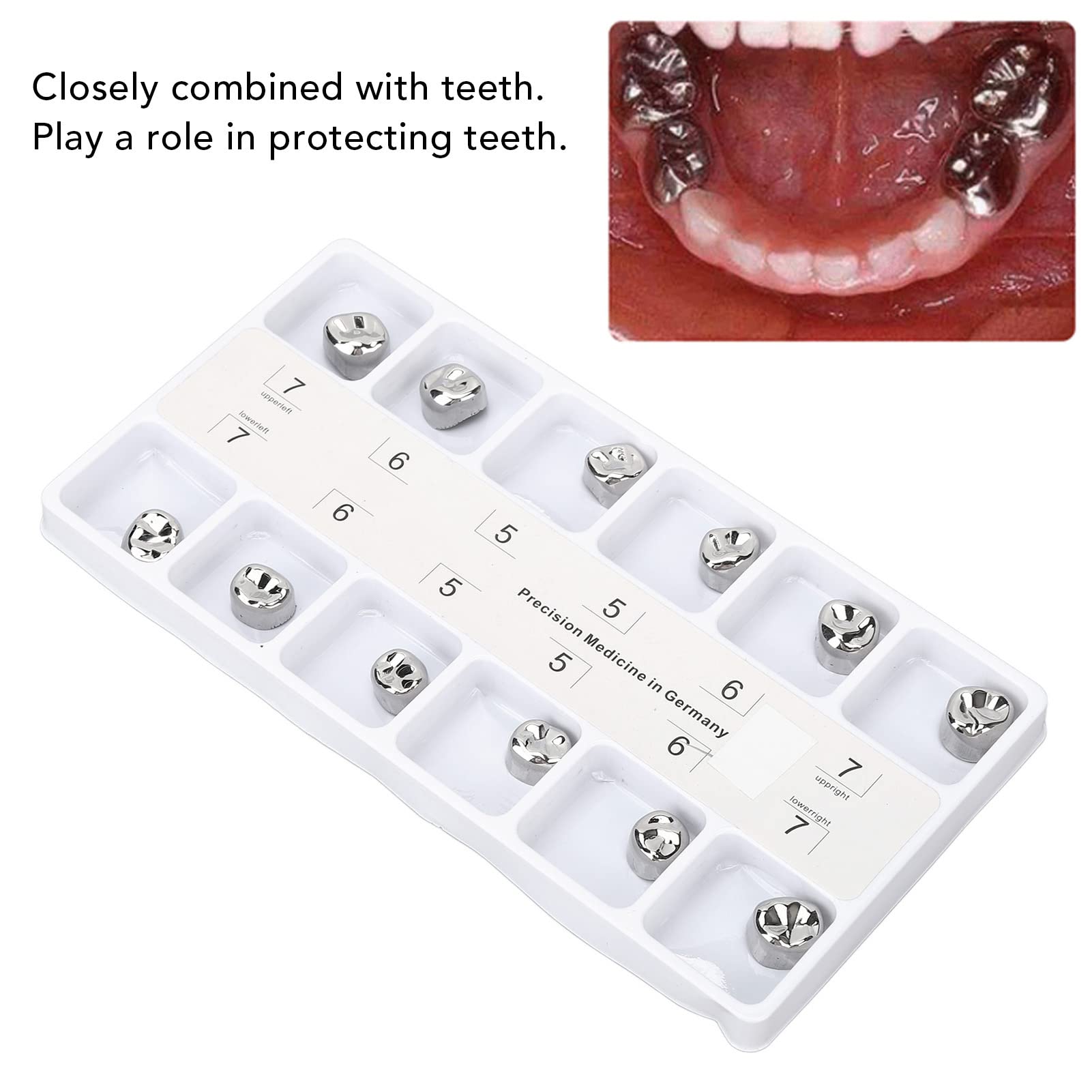 Stainless Steel Dental Crowns for Teeth - Anti-Rust Metal Molar Caps for Tooth Loss Prevention | Dental Clinic & Hospital Use