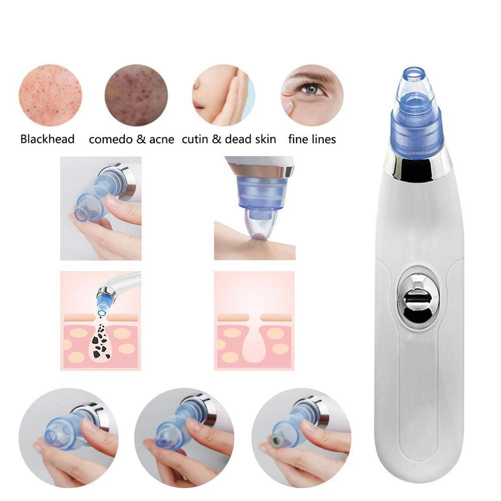 McMus Professional Acne Pore Cleaner & Blackhead Remover Kit - Facial Cleansing Vacuum Tool for Pimple & Acne Treatment - Skin Care Device for Men & Women - Perfect for Daily Deep Cleansing & Spa Skincare Routine