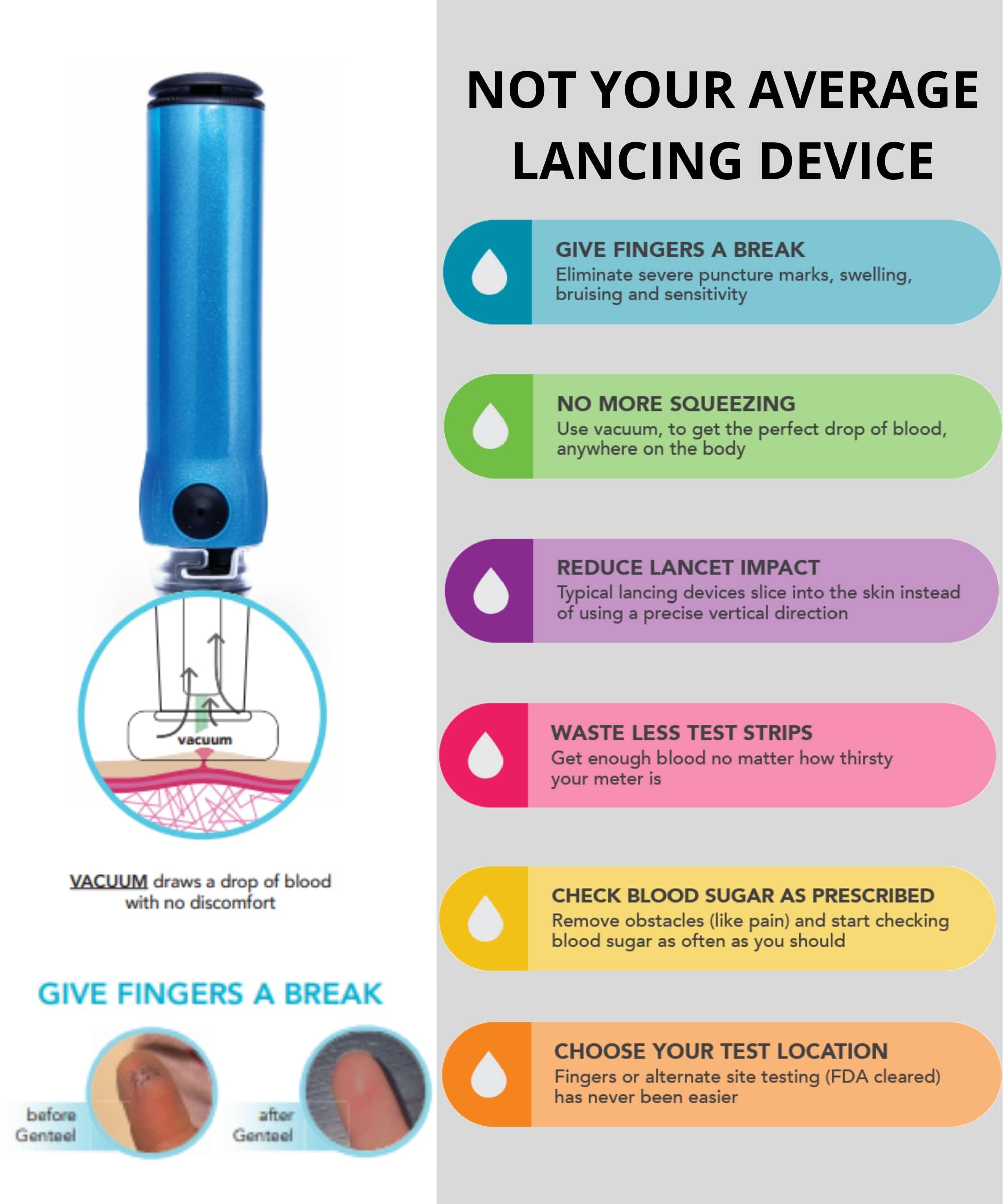 Genteel Plus Pain-Free Vacuum Lancing Device for Diabetes Testing - No Prick Blood Glucose, Ketone & DNA Home Test Kit (Butterfly Blue) - Ideal for Painless Fingerstick Testing at Home or Clinic
