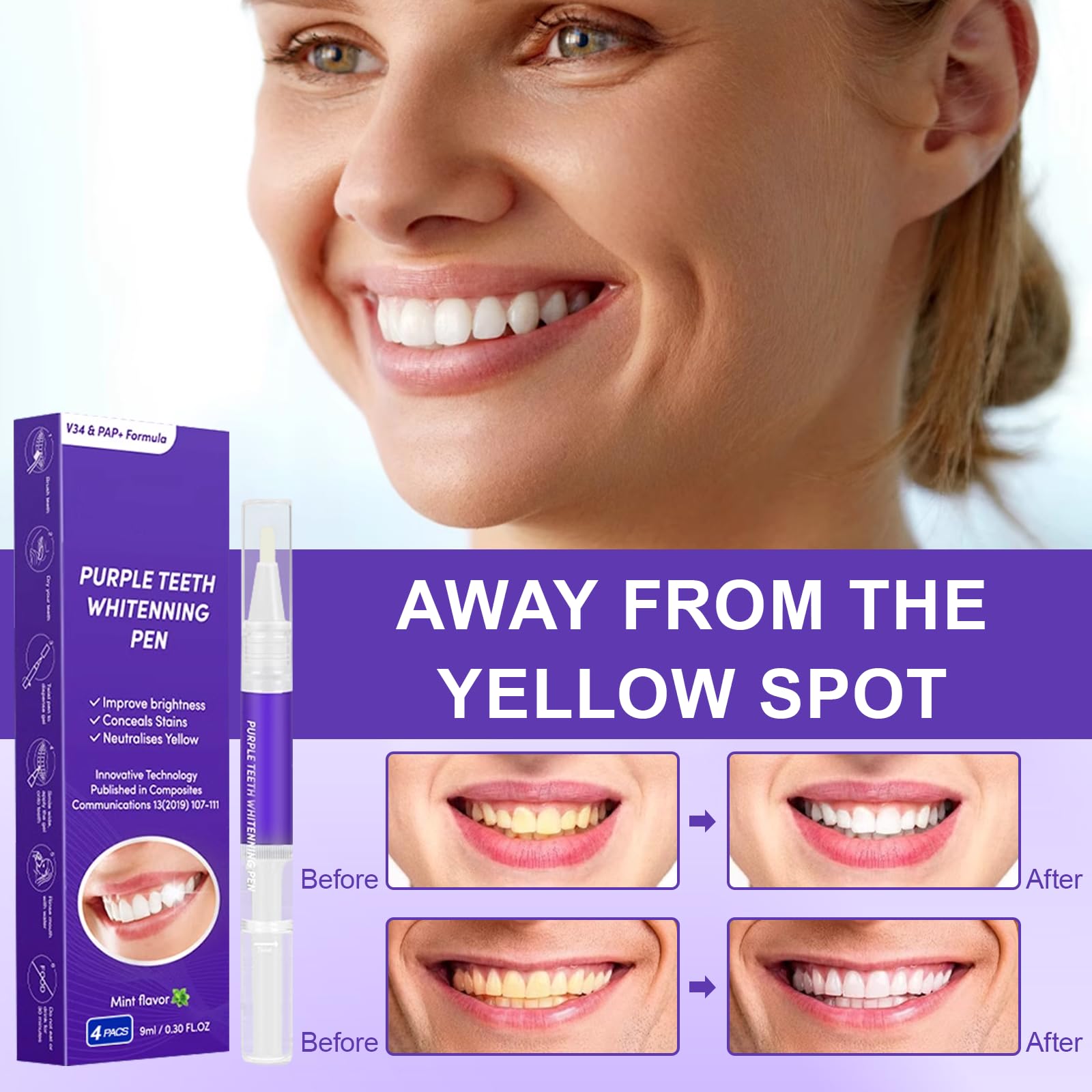 Landrain 4-Pack Teeth Whitening Pen Set - Purple Teeth Whitening & Stain Removal for Instant Brightening - Perfect for Travel, Home Use & Special Occasions