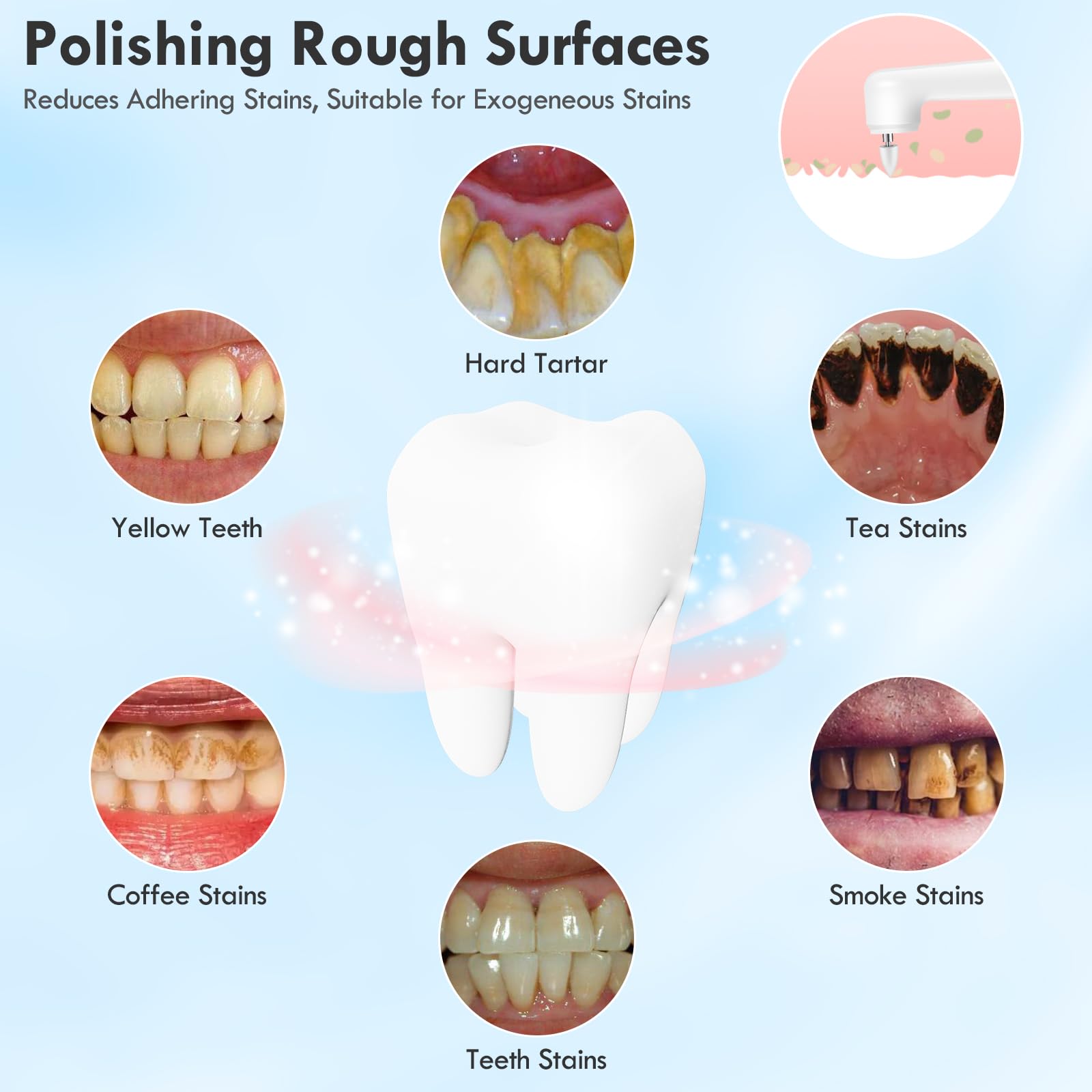 Rechargeable Electric Tooth Polisher Kit with LED Light - 5 Brush Heads & 5 Speed Modes for Teeth Whitening, Cleaning & Polishing - Waterproof Dental Care for Home & Travel Use